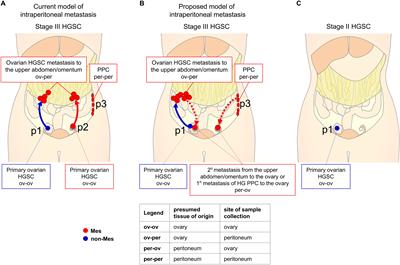 Are Epithelial <mark class="highlighted">Ovarian Cancers</mark> of the Mesenchymal Subtype Actually Intraperitoneal Metastases to the Ovary?